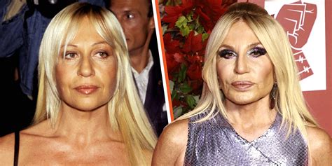 donayella versace|donatella versace plastic surgery.